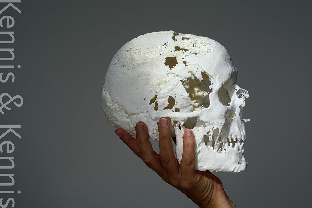 3d printed cranium of Tollund Man