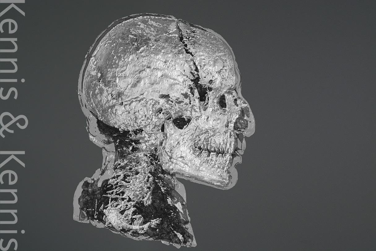 First phase of reconstructing Tollund Man; loading 3d data in the computer through a dicom file